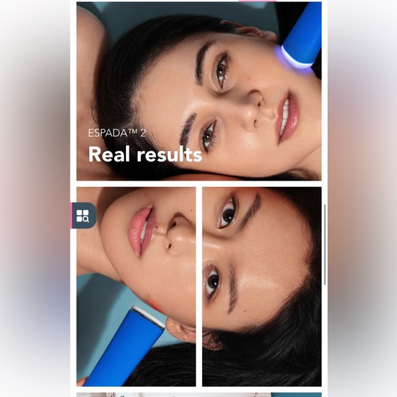 FOREO ESPADA 2 Blue LED therapy acne treatment device Like New - Picture 13 of 16